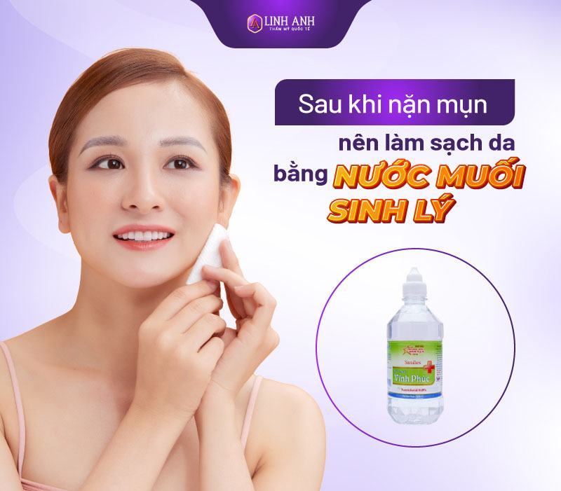 Thuốc Bôi Sau Khi Nặn Mụn Nặn Mụn Xong Nên Làm Gì Để Ngừa Thâm Tối Đa 